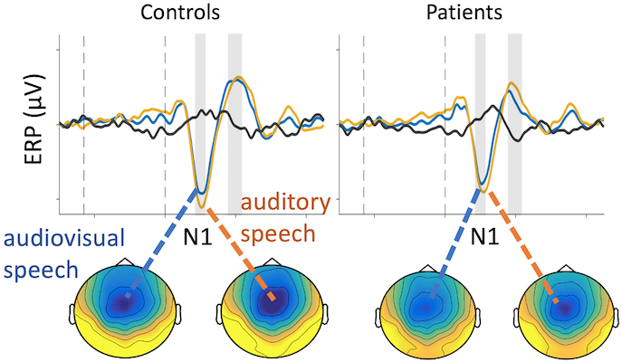 speechnoise SZ